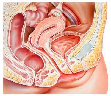 4D Ultrasound in Women With and Without Provoked Vestibulodynia